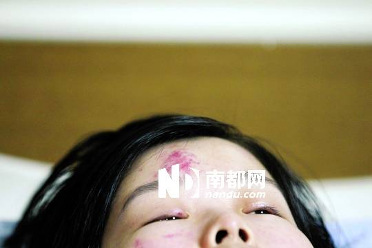 <p>    昨日，白巍在寶安人民醫(yī)院病房接受治療。南都記者 徐文閣 攝</p>