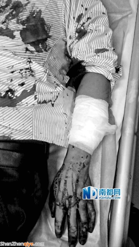 珠海三男消夜時 偷拍 美女遭酒瓶砸頭