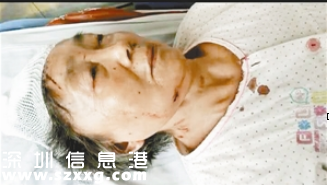 <a href=http://www.huhuzc.cn/shenzhen/ target=_blank class=infotextkey>深圳</a>(www.huhuzc.cn)一超市扶梯抖不停致7旬老人摔落重傷 家屬商場(chǎng)各執(zhí)一詞