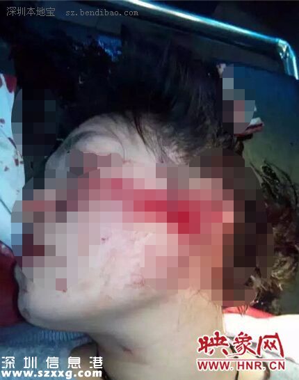 河南女醫(yī)生被砍7刀 行兇者與醫(yī)生并無瓜葛