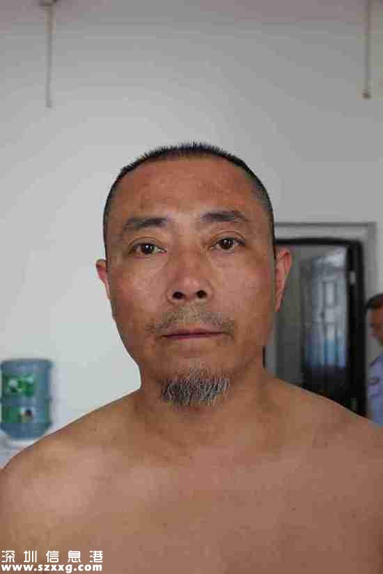 2013年4月22日，王志剛被轉(zhuǎn)送到劍閣縣看守所，重新檢查了身體狀況。照片顯示，王志剛的后背有條狀色素沉著。