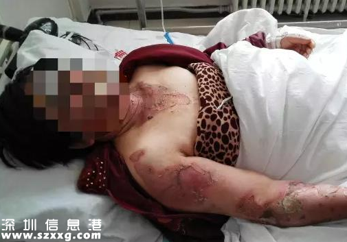 兒媳開水潑婆婆 專家支招解決婆媳關(guān)系