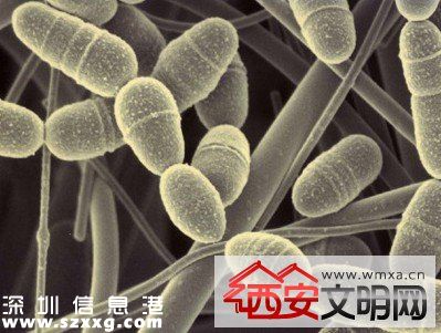 美國發(fā)現(xiàn)無敵細菌無藥可治 若擴散人類或?qū)⒃馐軠珥斨疄?zāi)