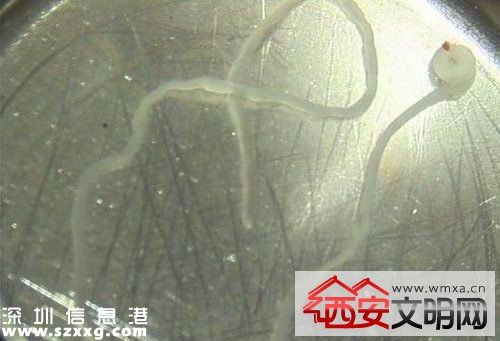 吉安籍男童腦里長寄生蟲 發(fā)現(xiàn)面部及右側肢體抽搐后送醫(yī)治療