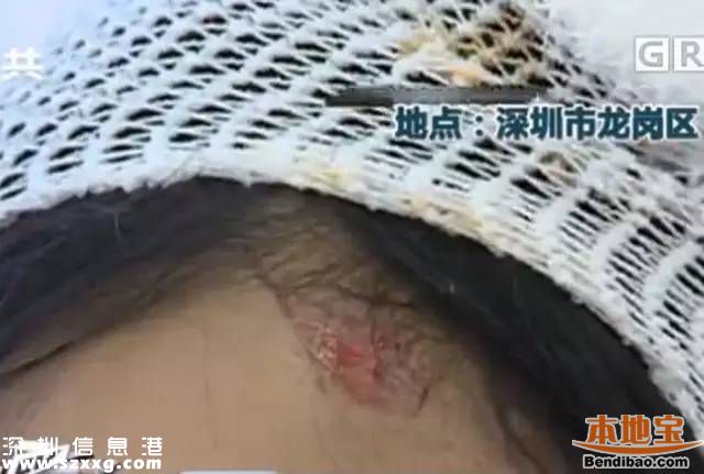 深圳3女子拒絕鄰座敬酒被打 被酒瓶椅子砸頭