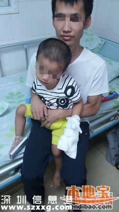 深圳2歲男童學(xué)爸爸用榨汁機(jī) 手指被絞