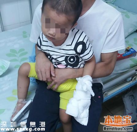 深圳2歲男童學(xué)爸爸用榨汁機(jī) 手指被絞