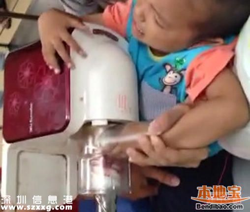 深圳2歲男童學(xué)爸爸用榨汁機(jī) 手指被絞