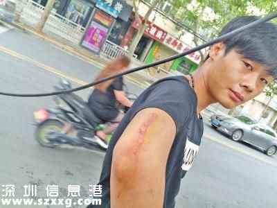 鄭州騎電動車小伙被線纜勒住脖子掛翻 生命垂危