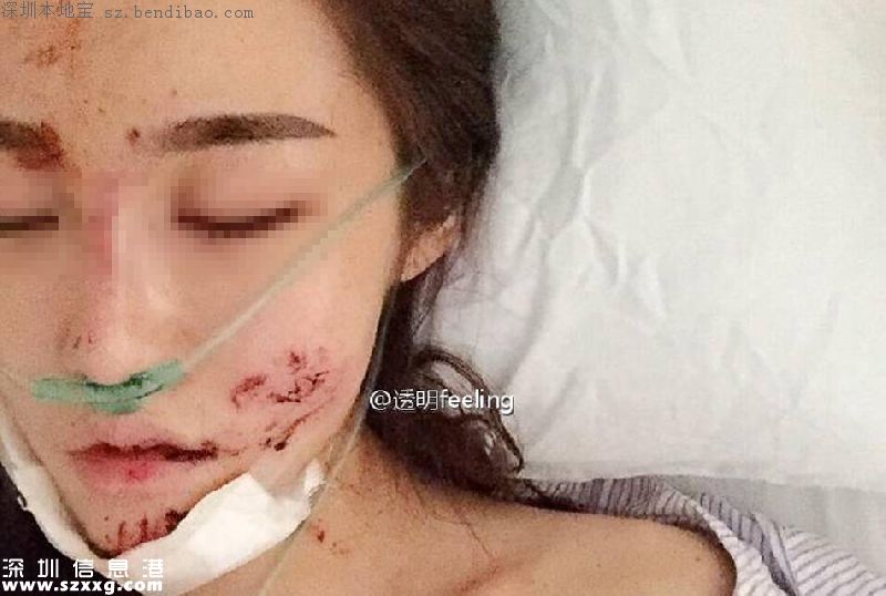 深圳女子乘豪車被毀容 肇事司機(jī)涉嫌頂包酒駕