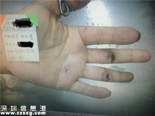 深圳滴滴司機(jī)遭乘客搶劫 被割傷還將被追責(zé)